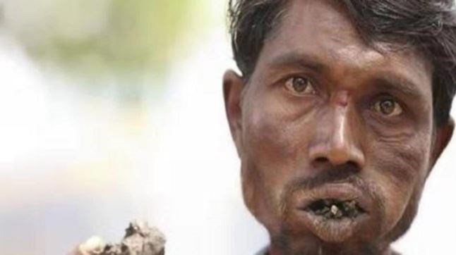 有人喜歡吃土,這都是什么特殊的愛(ài)好(圖2) 有人喜歡吃土,這都是什么特殊的愛(ài)好(圖2)