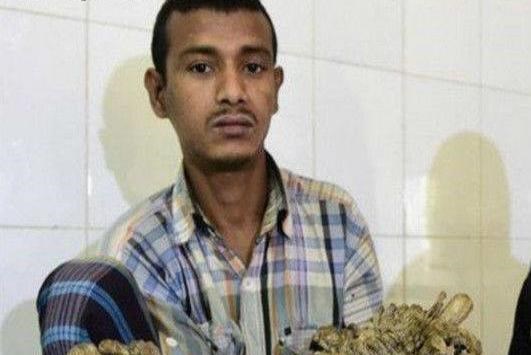 印度一男子得怪病,長滿樹枝,妻子生完兩個(gè)孩子后,棄他而去!_圖1 印度一男子得怪病,長滿樹枝,妻子生完兩個(gè)孩子后,棄他而去!_圖1