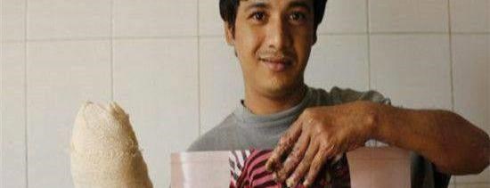 印度一男子得怪病,長滿樹枝,妻子生完兩個(gè)孩子后,棄他而去!_圖2 印度一男子得怪病,長滿樹枝,妻子生完兩個(gè)孩子后,棄他而去!_圖2